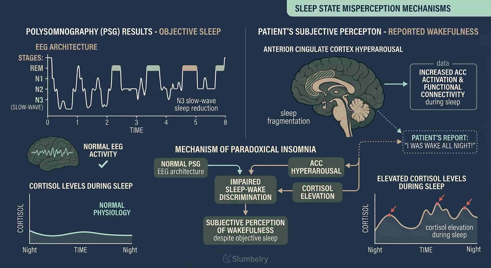 Scientific medical diagram comparing polysomnography PSG results vs subjective sleep perception: normal sleep EEG architecture but patient reports wakefulness, anterior cingulate cortex hyperarousal, cortisol elevation during sleep, sleep state misperception mechanism, dark blue medical illustration